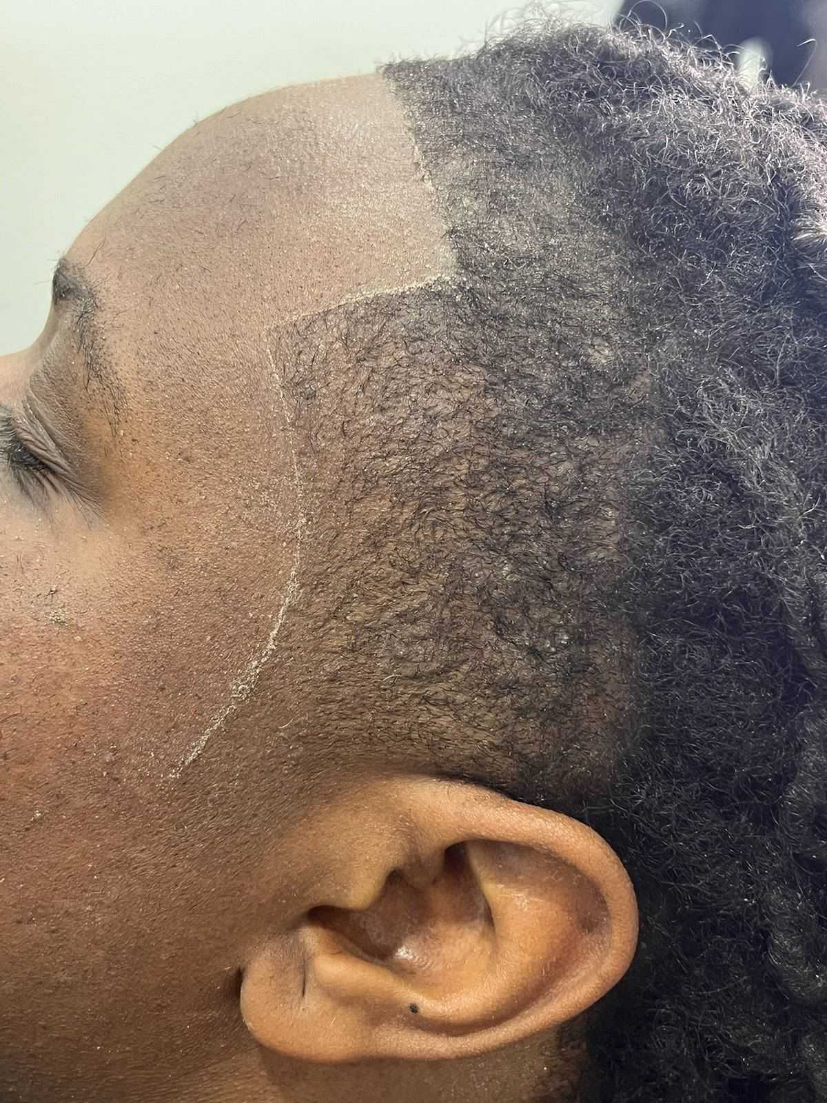 Man with lined-up haircut on the side of the head.